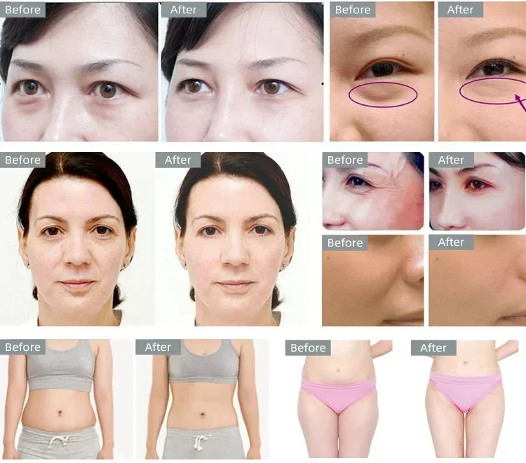 Moonic Beauty 40K Cavitation Ultrasonic Weight Loss Machine