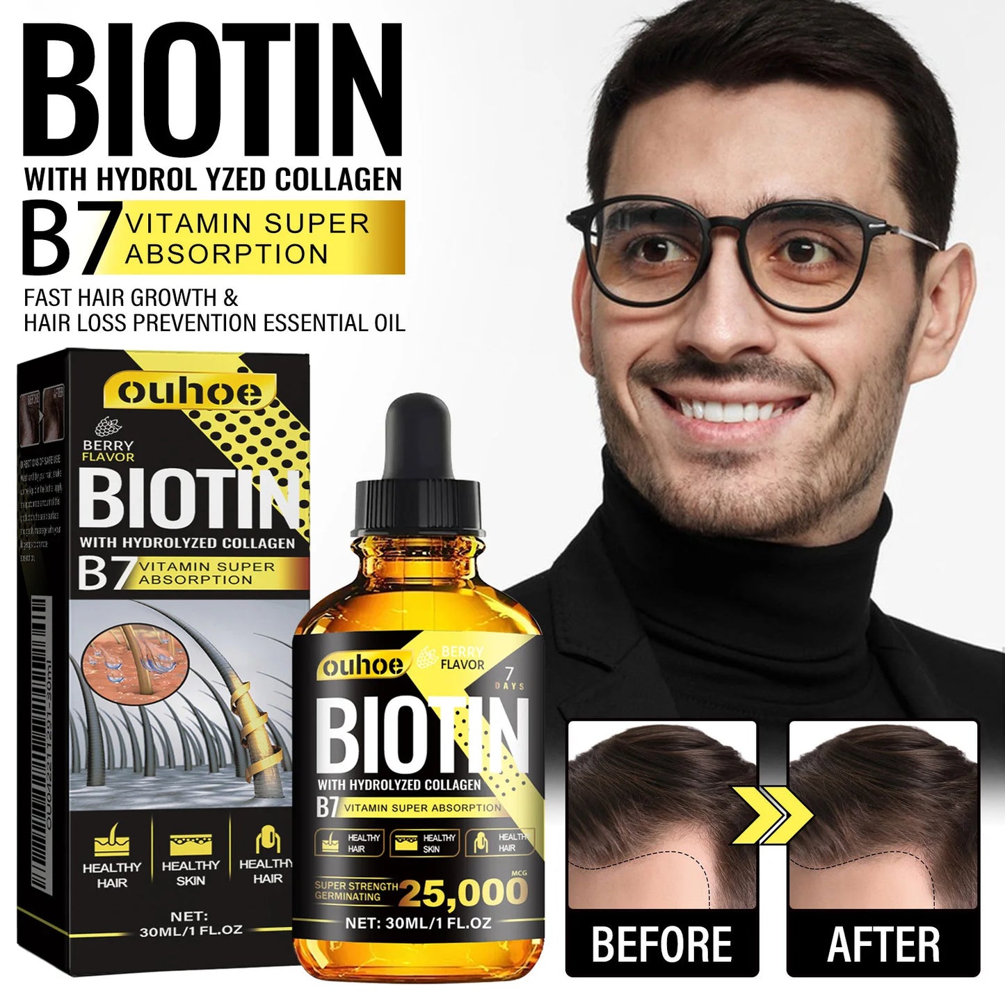 Ouhoe Collagen B7 Hair Growth Serum For Scalp Moisture Repair