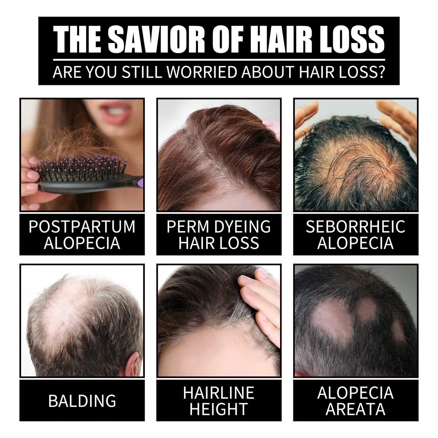 Ouhoe Collagen B7 Hair Growth Serum For Scalp Moisture Repair