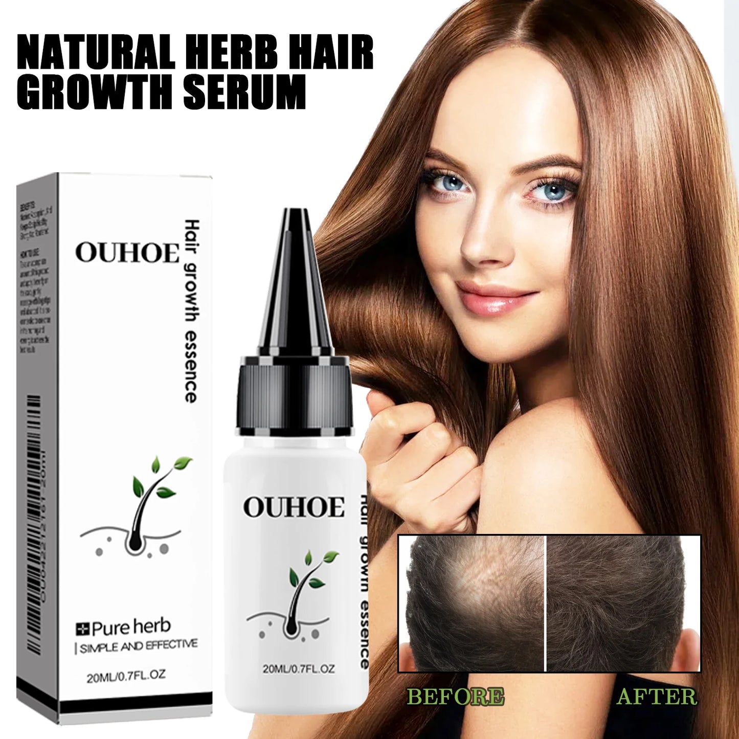 Ouhoe Herbal Dense Hair Growth Essence For Scalp Care
