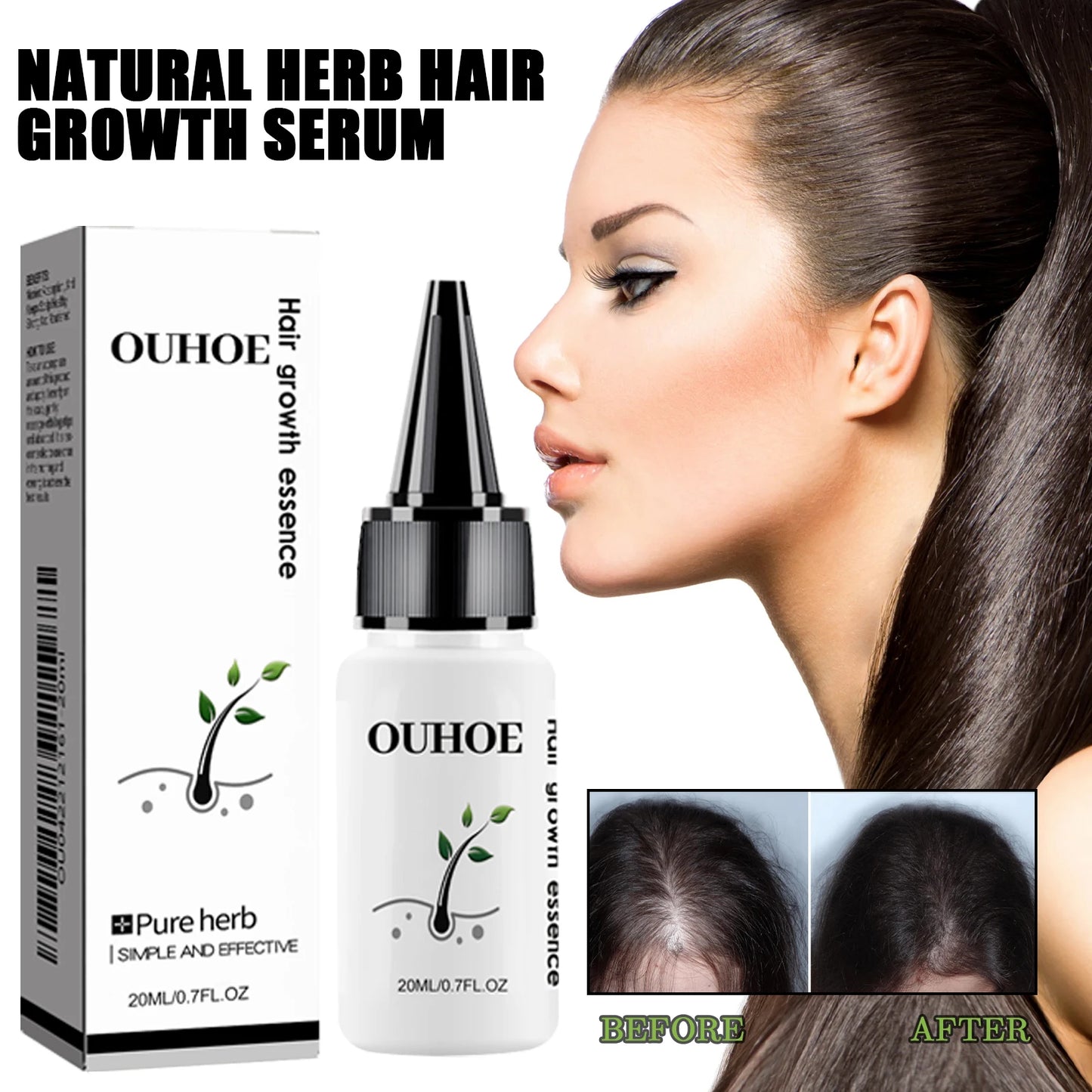 Ouhoe Herbal Dense Hair Growth Essence For Scalp Care